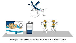 INVOS™ oximetry in the NICU Byte 9 NIRS as a signal of hypocarbiainduced cerebral vasoconstriction [upl. by Ydneh]