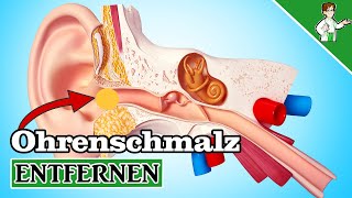 Ohrenschmalz entfernen  5 Möglichkeiten zum Ohren reinigen [upl. by Etnomal]