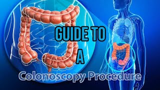 Guide to your Colonoscopy gastroenterology colonoscopy [upl. by Lasley35]