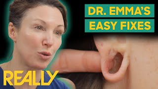 Dr Emma Has Easy Solutions To Incurable Problems  The Bad Skin Clinic [upl. by Aissert]