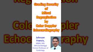 Grading severity of mitral regurgitation by color Doppler echocardiography [upl. by Divadnoj333]