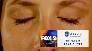 Watery Eyes May Mean Blocked Tear Ducts  SLUCare Health Watch [upl. by Ahsata919]