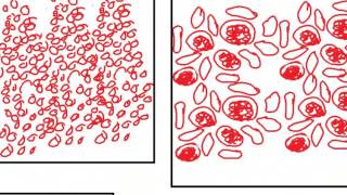 PATHOLOGY SLIDES 7 DR SAMEH GHAZY [upl. by Errol]