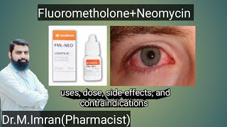 FML NEO eye drops are used in urdu  eye drops  Medicine information [upl. by Annay752]