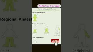 Types of anaesthesia medicostudent anaesthesia new viral shorts [upl. by Robinia520]