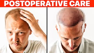 Hair Transplant PostOp Recovery [upl. by Lavinia534]