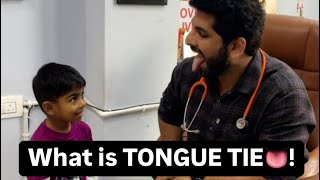 What to do in Tongue tie👅 tonguetie tongue speechdelay ankyloglossia [upl. by Baudoin]