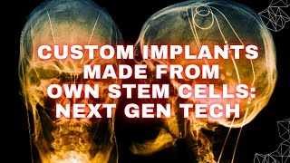 Custom implants made from patients stem cells Next Gen Tech [upl. by Aivata]