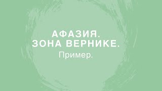 ИНСУЛЬТ СЕНСОРНАЯ АФАЗИЯ зона Вернике Обследование пациентаFluent aphasia [upl. by Ciccia301]