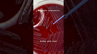 Moraxella catarrhalis Hocky Puck sign microbiology [upl. by Cave10]