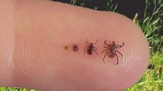 Doctor explains what you should know about ticks [upl. by Massie]