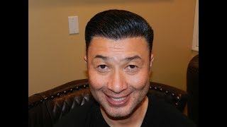 Hair Transplant 10th Month Follow Up Restoration Surgery Progress Dr Diep httpwwwmhtacliniccom [upl. by Atinor94]