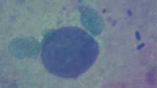 Pulmonology Chlamydiosis Chlamydia Pneumoniae [upl. by Satterfield]