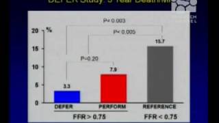 Who Needs a Coronary Artery Stent [upl. by Purvis]