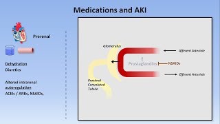 Acute Kidney Injury Part 13  Definitions and Etiologies [upl. by Yelsnit557]