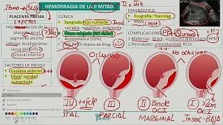 Obstetricia  Hemorragia de la II Mitad [upl. by Perr]