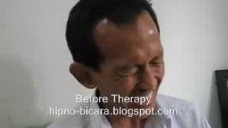 Stammering Stuttering Hypnotherapy  Terapi GAGAP [upl. by Nick224]