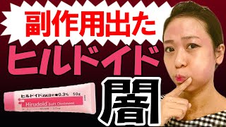 【ヒルドイドの闇】使い続けた結果…アトピー悪化。添付文を簡単に解説 [upl. by Arondel524]