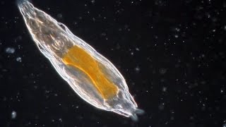 Bdelloid Rotifers so common yet so weird [upl. by Melgar]