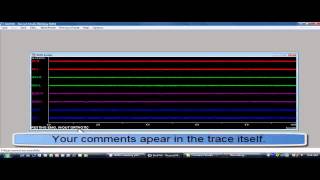 BioEMG  How to Set up the Craniofacial EMG Electromyography Unit [upl. by Andrel747]