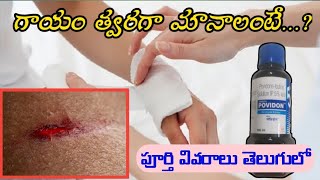 Povidone Iodine Solution Uses In Telugu  Antiseptic  Microbicidal Solution [upl. by Eikciv]