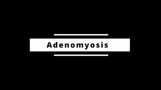 Adenomyosis [upl. by Innattirb907]