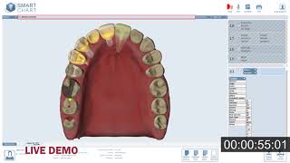 SmartChart™  3D Odontogram Demo [upl. by Luar]