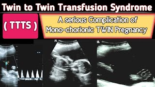 TTTS  Twin to Twin Transfusion Syndrome Ultrasound  A Serious COMPLICATION [upl. by Nodnahs]