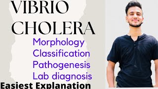 Vibrio Cholera  Vibrio Cholera Microbiology [upl. by Elianore]