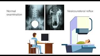 The CARE foundation  Ultrasound cystography [upl. by Nottap]