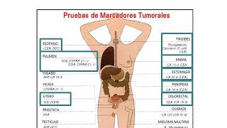 Marcadores Tumorales [upl. by Nalac785]