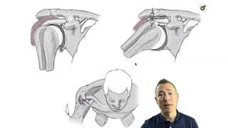 Scapular Dyskinesis  ChiroUp [upl. by Fisher]