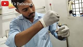 BLOOD CROSS MATCH  M K PATHOLOGY  Lab Technician Pathology  blood cross match tips [upl. by Vipul]