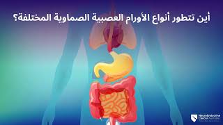 Symptoms Types and Diagnosis of Neuroendocrine Tumours NETs  Arabic Version [upl. by Anairuy]