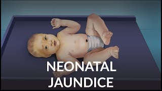 Neonatal Jaundice by L Veit  OPENPediatrics [upl. by Arteid885]