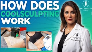 How Does Coolsculpting Work [upl. by Oilla]