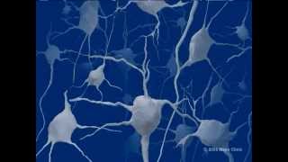 Mayo Clinic Medical Animation  Lewy Body Dementia [upl. by Ernst]