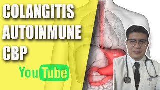 COLANGITIS AUTOINMUNE [upl. by Alvinia]