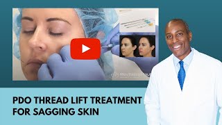 PDO Thread Lift Treatment for Sagging Skin in the Lower Face I RevitalizeMaui [upl. by Spiers31]