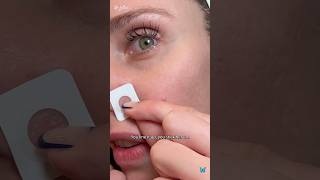 How An Esthetician Gets Rid Of A Pimple In 1 Day Zitsticka Killa Patch zitsticka acne skincare [upl. by Boggers75]