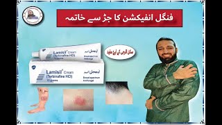 Lamisil Cream uses in urdu  Terbinafine Hydrochloride cream  How to treat Fungal Infection Review [upl. by Ednyl668]