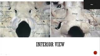 Anatomy of Jugular Foramen [upl. by Anelah]