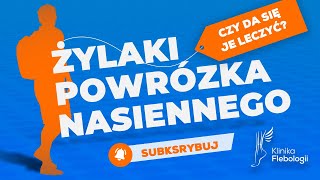 Żylaki powrózka nasiennego  czy da się je leczyć [upl. by Ellenehs]