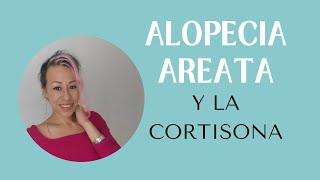 ALOPECIA AREATA y la cortisona [upl. by Anelak]