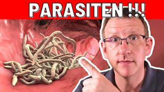 10 Frühwarnzeichen von Parasiten die sofortiges Handeln erfordern [upl. by Issie]