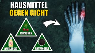 10 Natürliche Hausmittel gegen Gicht [upl. by Magdau]