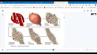 4447 CONCEPTS OF CARE FOR PTS WITH MUSKULOSKELETAL TRAUMA PART 1 [upl. by Ahrat]