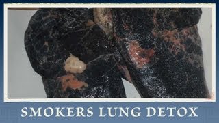 7 Steps on How to Heal and Recover Lungs from Smoking [upl. by Keefe]