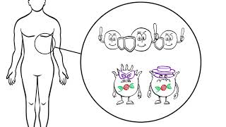 Stage IV Melanoma Cancer Treatment Options Explained Immunotherapy and Targeted Therapy [upl. by Ecyak]