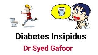 Approach To Polyuria  Diabetes Insipidus DrSyed Gafoor [upl. by Udelle]